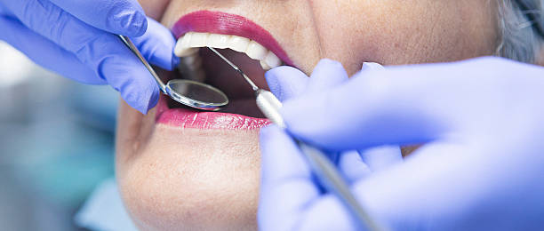 Best Emergency Dental Care for Broken or Chipped Teeth in Sabetha, KS